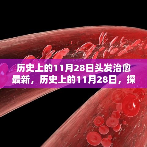 歷史上的11月28日，探尋頭發(fā)治愈的最新篇章??