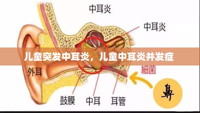 兒童突發(fā)中耳炎，兒童中耳炎并發(fā)癥 